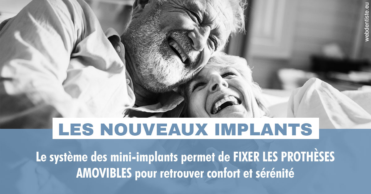 https://dr-treil-bruno.chirurgiens-dentistes.fr/Les nouveaux implants 2