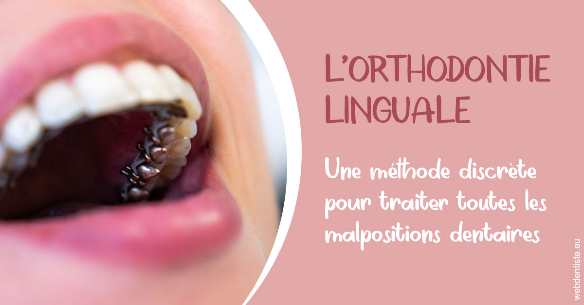 https://dr-treil-bruno.chirurgiens-dentistes.fr/L'orthodontie linguale 2