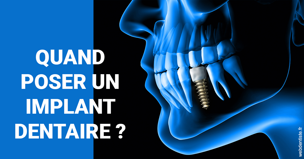 https://dr-treil-bruno.chirurgiens-dentistes.fr/Les implants 1