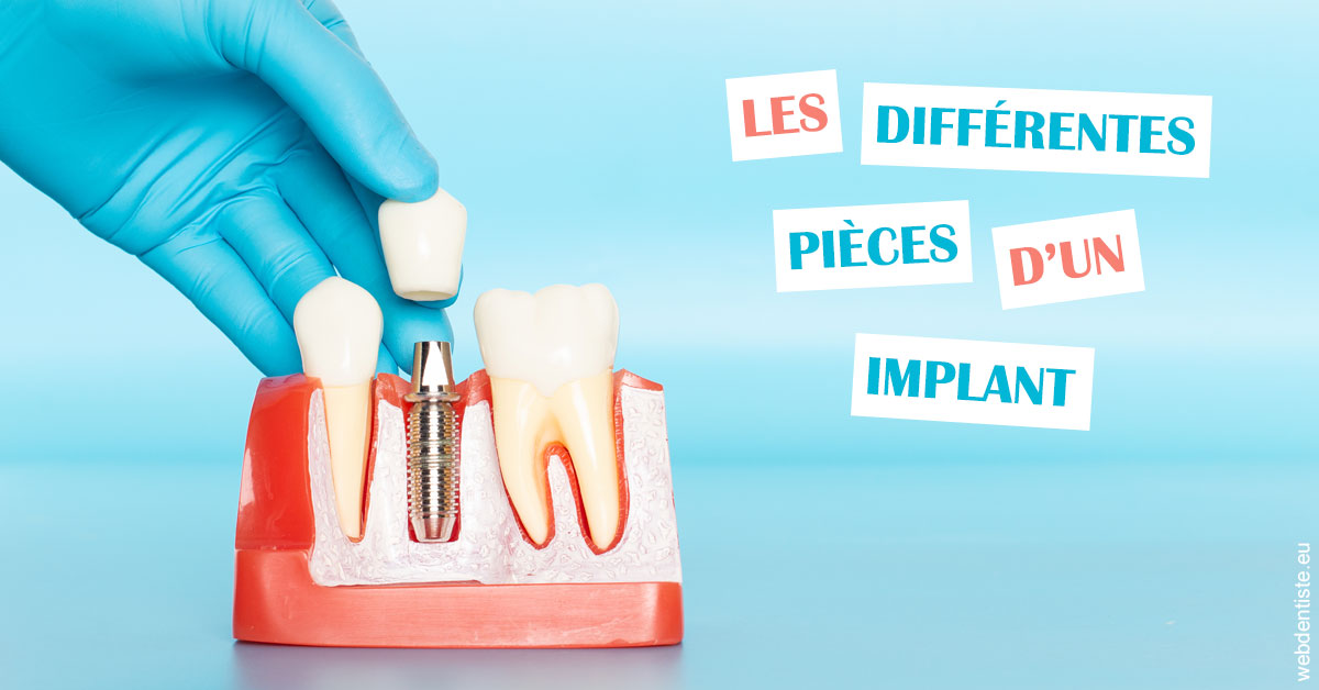 https://dr-treil-bruno.chirurgiens-dentistes.fr/Les différentes pièces d’un implant 2