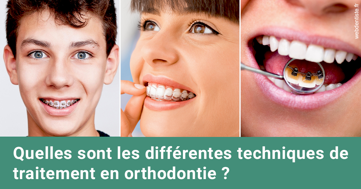 https://dr-treil-bruno.chirurgiens-dentistes.fr/Les différentes techniques de traitement 2