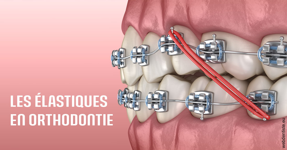 https://dr-treil-bruno.chirurgiens-dentistes.fr/Elastiques orthodontie 2