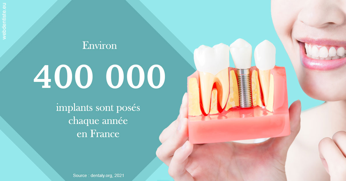 https://dr-treil-bruno.chirurgiens-dentistes.fr/Pose d'implants en France 2